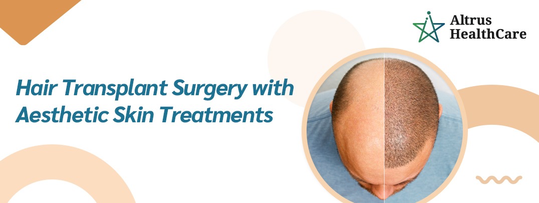 Hair Replacement Surgery